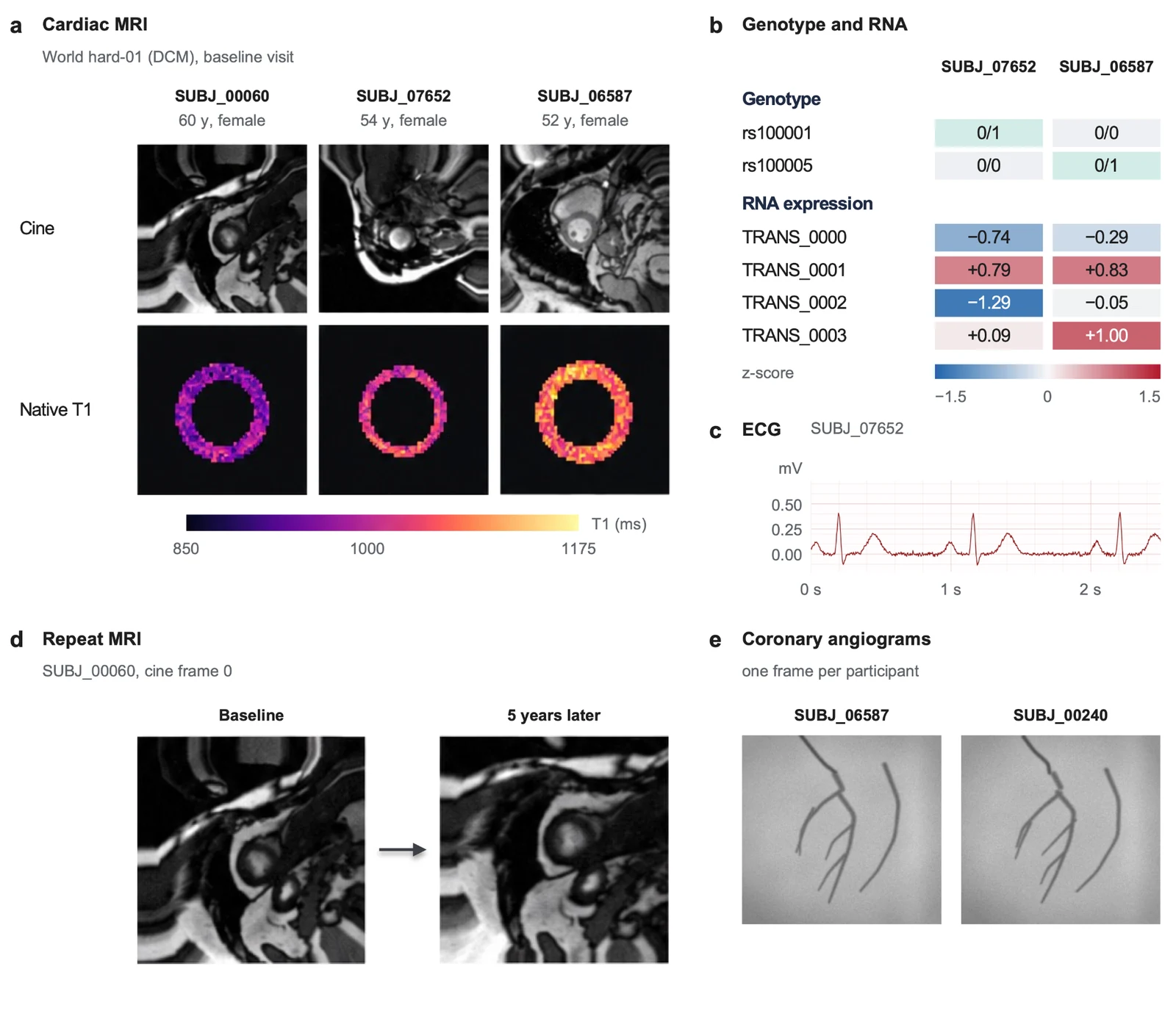 The simulated biobank: example data from world hard-01 (DCM)